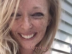 Xfreckledx